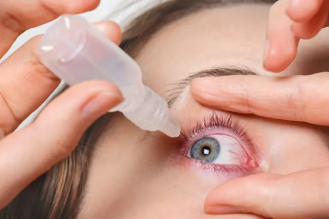 علاج احمرار العين ونزول دموع